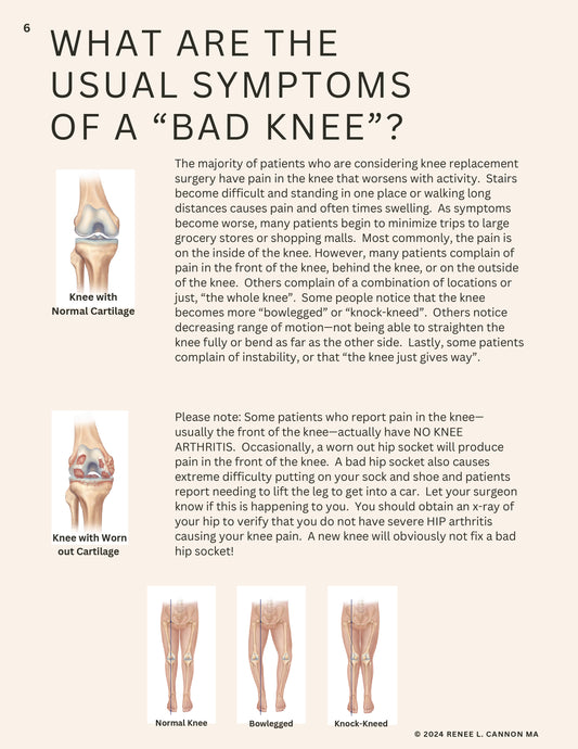 TOTAL KNEE - LESS SWELLING  LESS PAIN